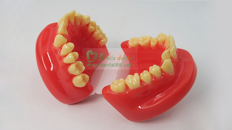 Orthodontic Model